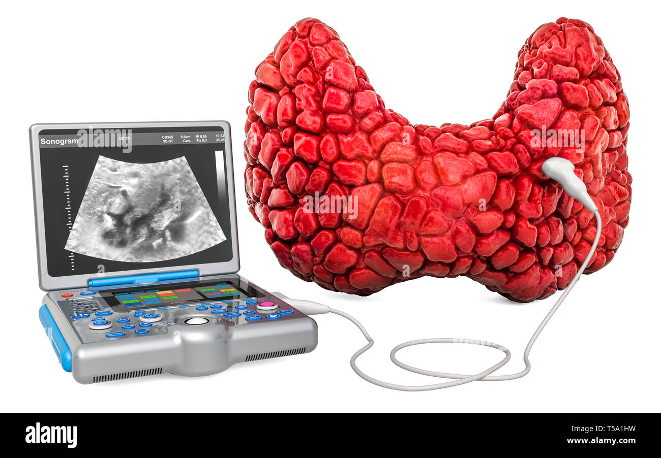 Tiroide concetto ad ultrasuoni. Tiroide umana con Medical Ultrasound macchina diagnostica, rendering 3D isolati su sfondo bianco Foto Stock