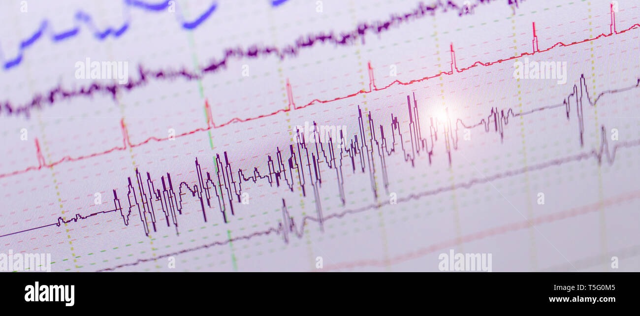 La salute di analisi dei dati Foto Stock