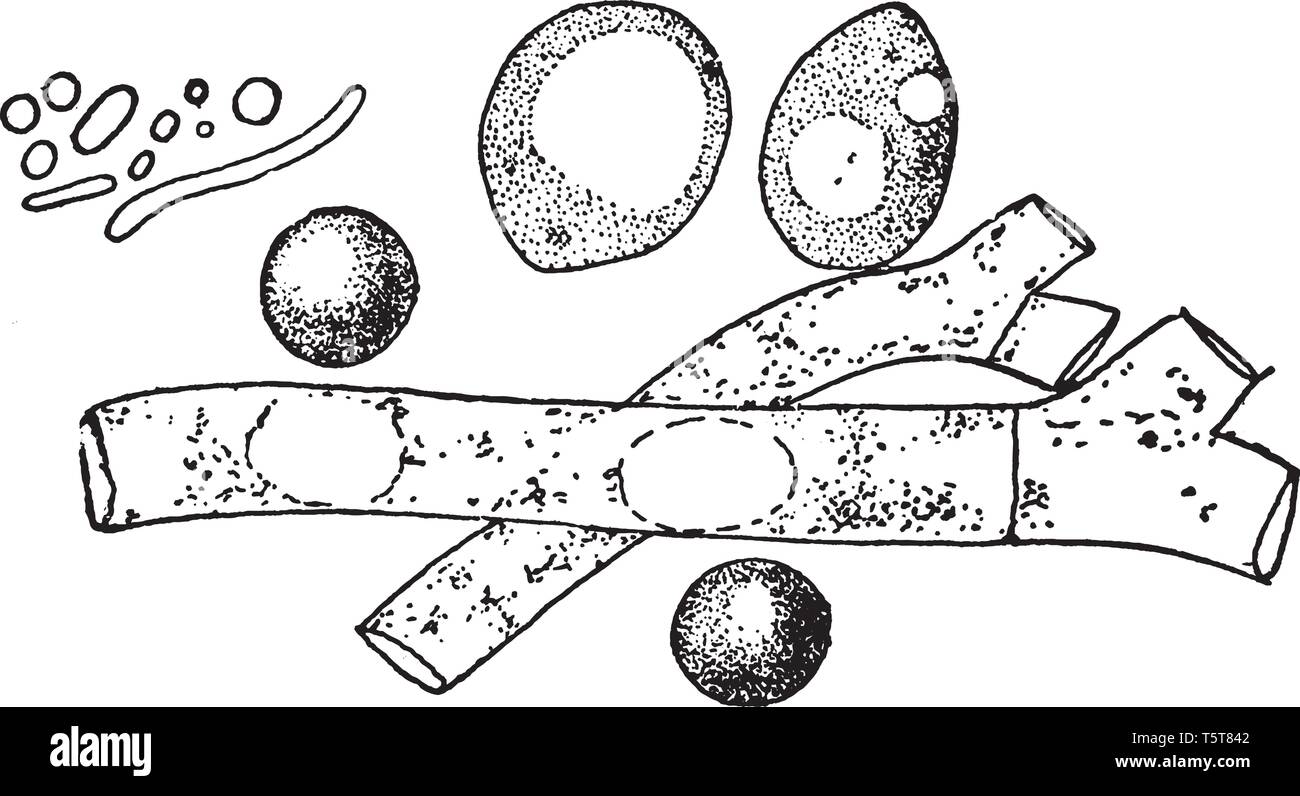 Una foto che mostra la dimensione comparativa di muffe e lieviti e batteri, vintage disegno della linea di incisione o illustrazione. Illustrazione Vettoriale