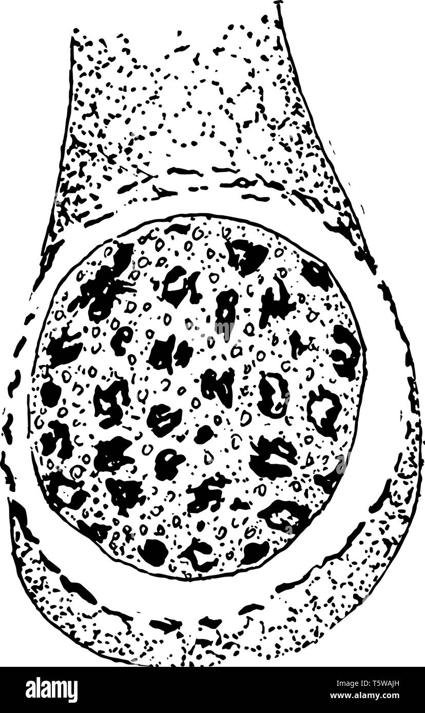 Una illustrazione della formazione del CCyclospora Cayetanensis spermatozooids, vintage disegno della linea di incisione o illustrazione. Illustrazione Vettoriale