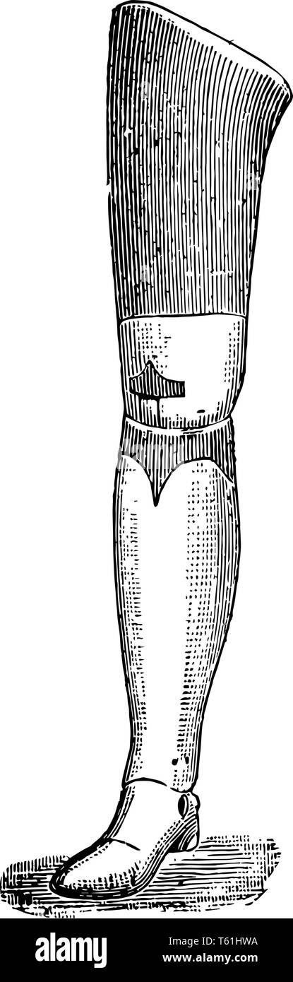 Un arto protesico che sostituisce una parte del corpo mancanti vintage disegno della linea di incisione o illustrazione. Illustrazione Vettoriale