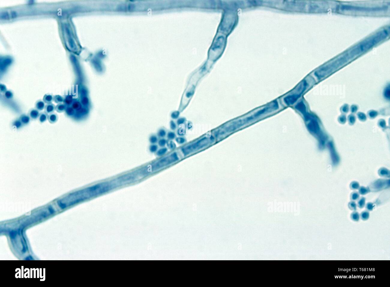 La fotomicrografia del phialides con terminale conidi del Madurella mycetomatis fungo, 1961. Immagine cortesia di centri per il controllo e la prevenzione delle malattie (CDC) / Dr Lucille K. Georg. () Foto Stock