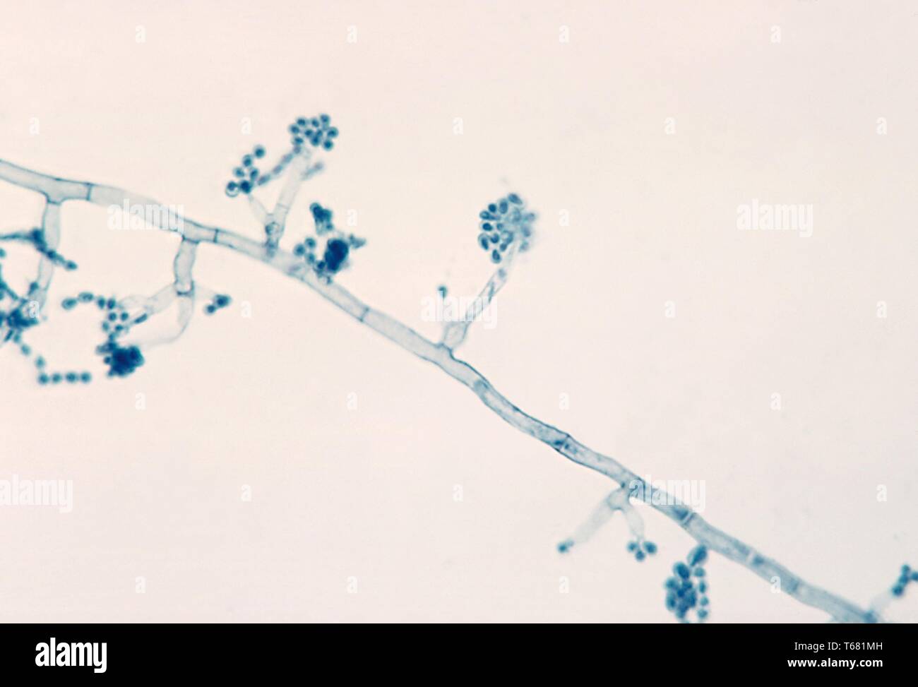 La fotomicrografia del phialides con terminale conidi del Madurella mycetomatis fungo, 1961. Immagine cortesia di centri per il controllo e la prevenzione delle malattie (CDC) / Dr Lucille K. Georg. () Foto Stock