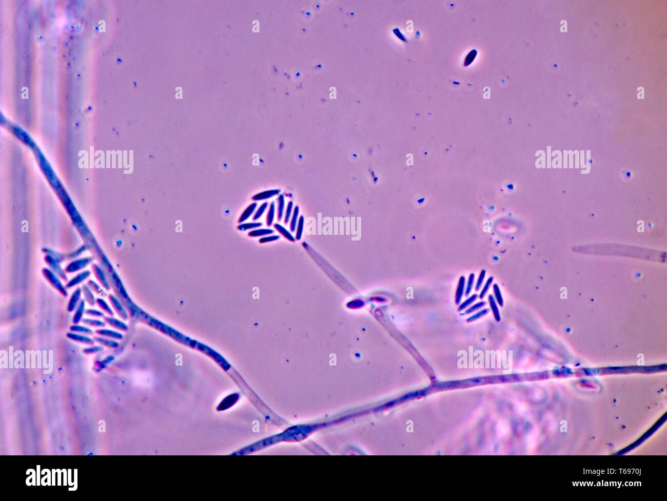 La fotomicrografia di conidi e conidiofori del fungo Fusarium verticillioides, 1978. Immagine cortesia di centri per il controllo e la prevenzione delle malattie (CDC) / Dr Libero Ajello. () Foto Stock