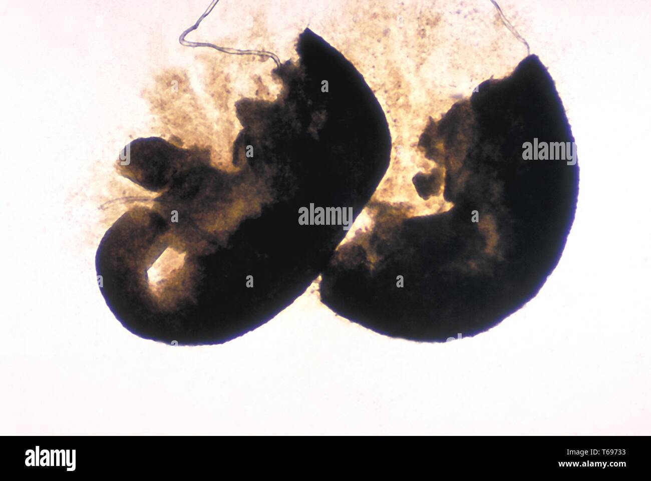 Granuli del fungo Madurella grisea, fonte di infezione caratterizzata da sclerozi, elaborati sul monte di idrossido di potassio, 1970. () Foto Stock
