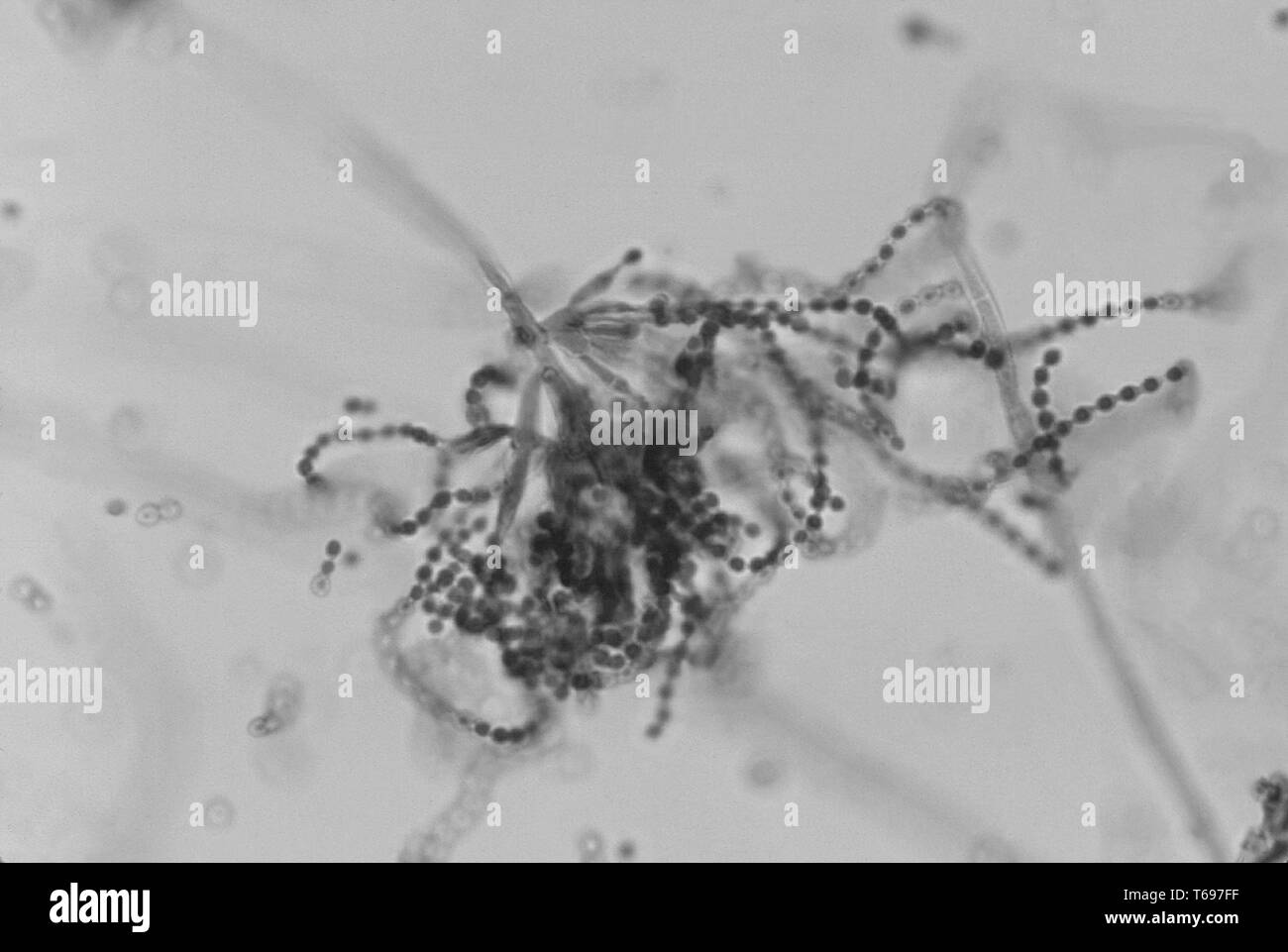 La fotomicrografia di conidiofori con conidi di Penicillium marneffei, isolato da un ascessi splenici, 1971. Immagine cortesia di centri per il controllo e la prevenzione delle malattie (CDC) / Dr Lucille K. George, Dr Arthur DiSalvo. () Foto Stock