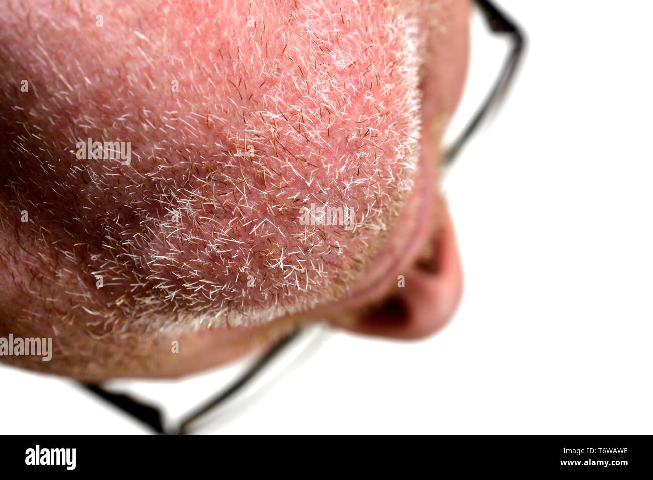 La crescita delle stoppie,su un mans mento,close up,dettaglio, Foto Stock