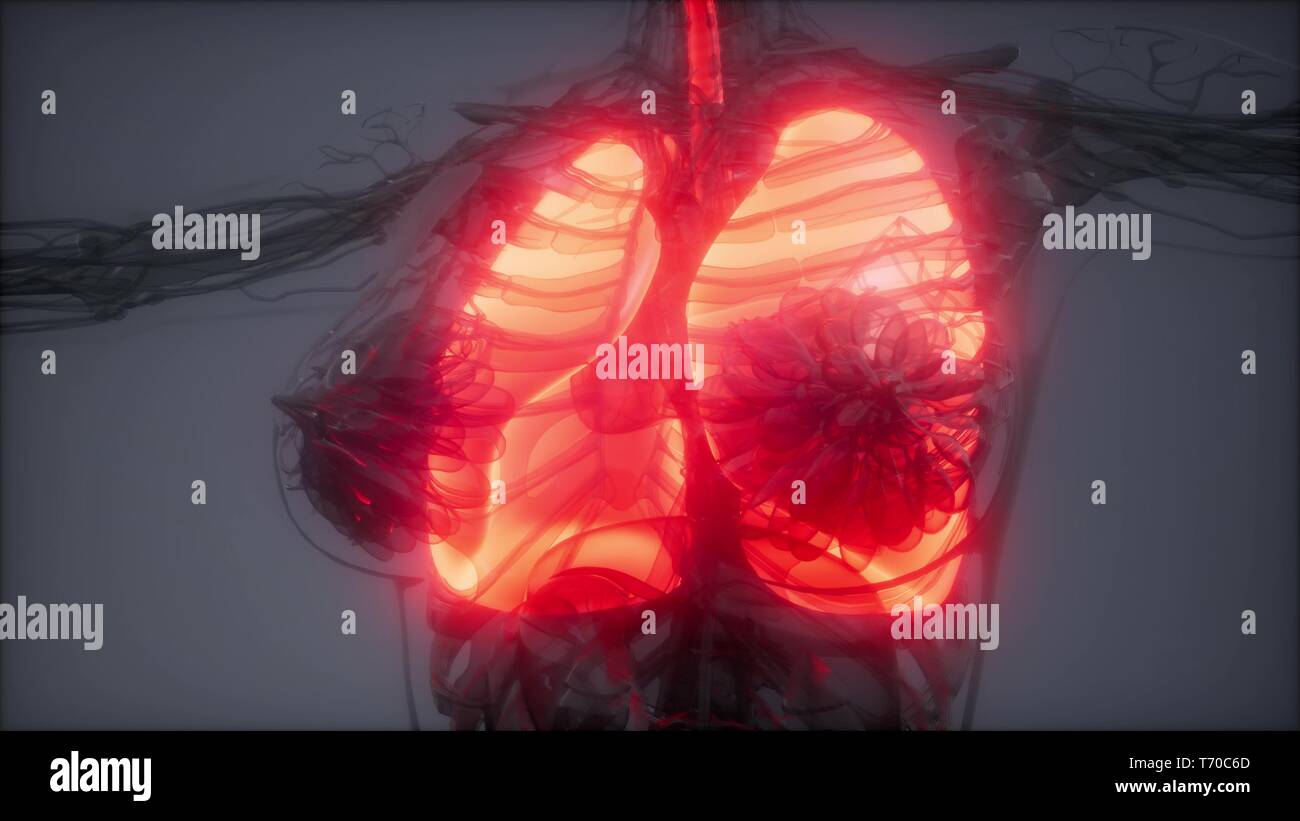 Polmoni umani esame radiologico Foto Stock