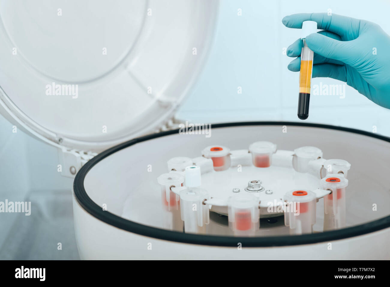 I campioni di sangue in flaconcini su una macchina centrifuga di close-up. Ematologia Foto Stock
