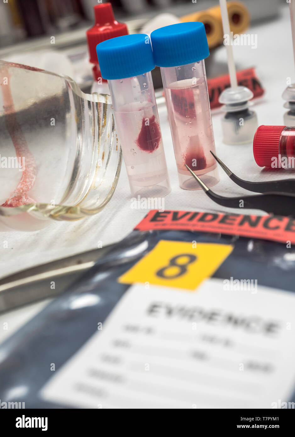 I tamponi con il campione di sangue da analizzare in laboratorio, immagine concettuale Foto Stock