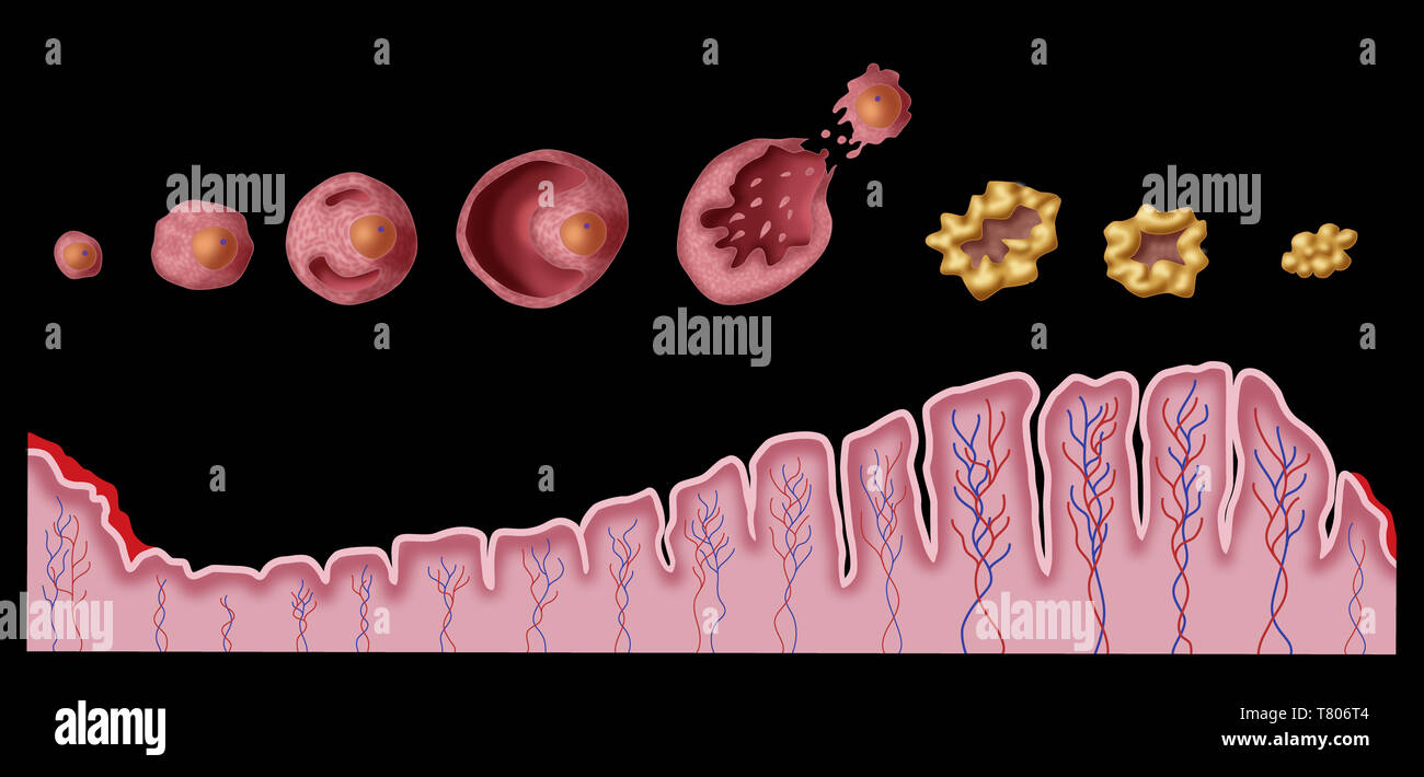 Atlante ed epitome di ginecologia. L epoch e quando la tensione  intra-addomi-nale è aumentata. Sterilità, dalla solita combi-nazione con  ooforite. Febbre (in gonorrea, solo post-sforzo o eccitazione). Prognosi -  la concezione