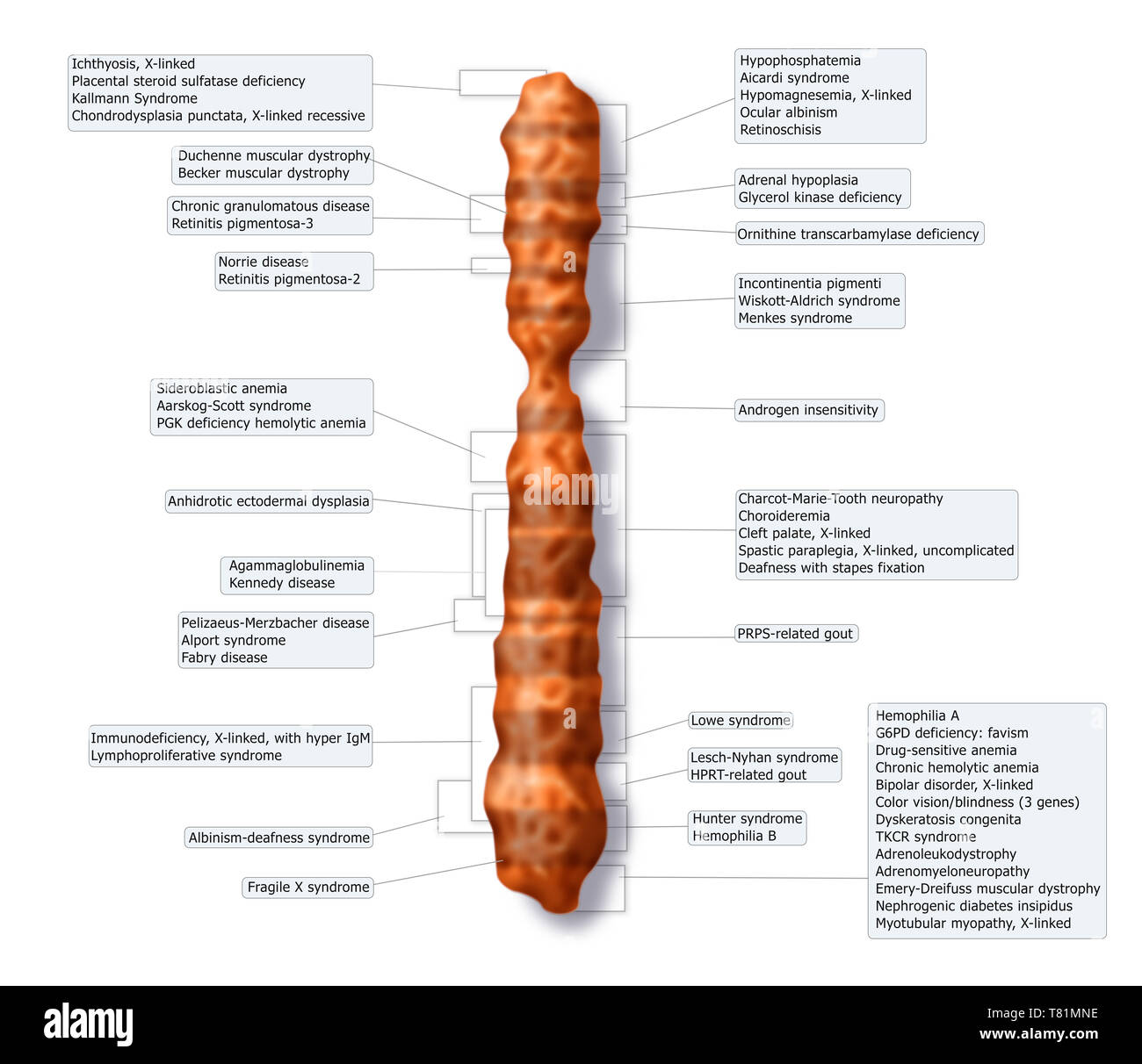Il cromosoma X Mappa di malattia, illustrazione Foto Stock