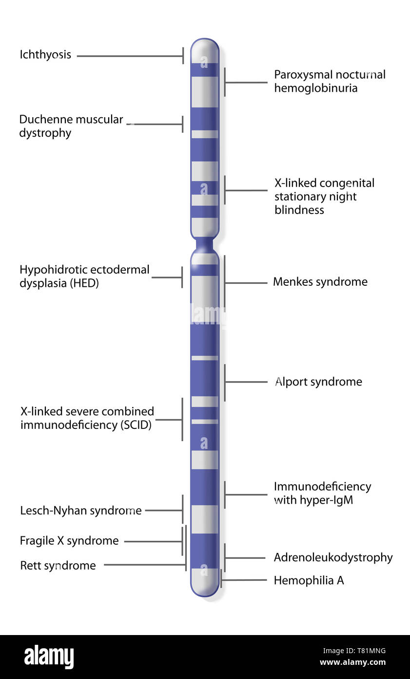 Il cromosoma X Mappa di malattia, illustrazione Foto Stock