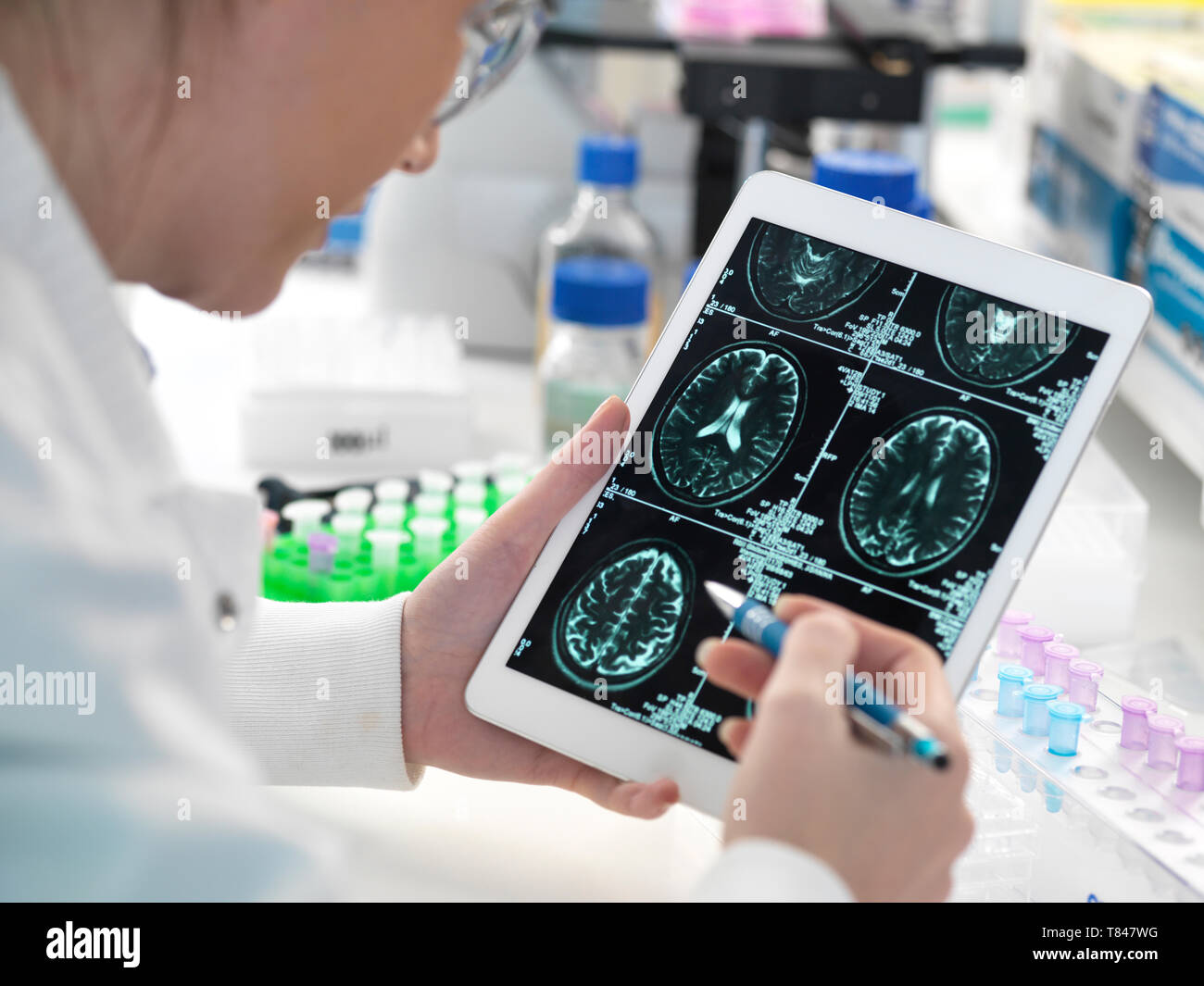 Visualizzazione medico paziente scansione cerebrale sulla tavoletta digitale in laboratorio Foto Stock