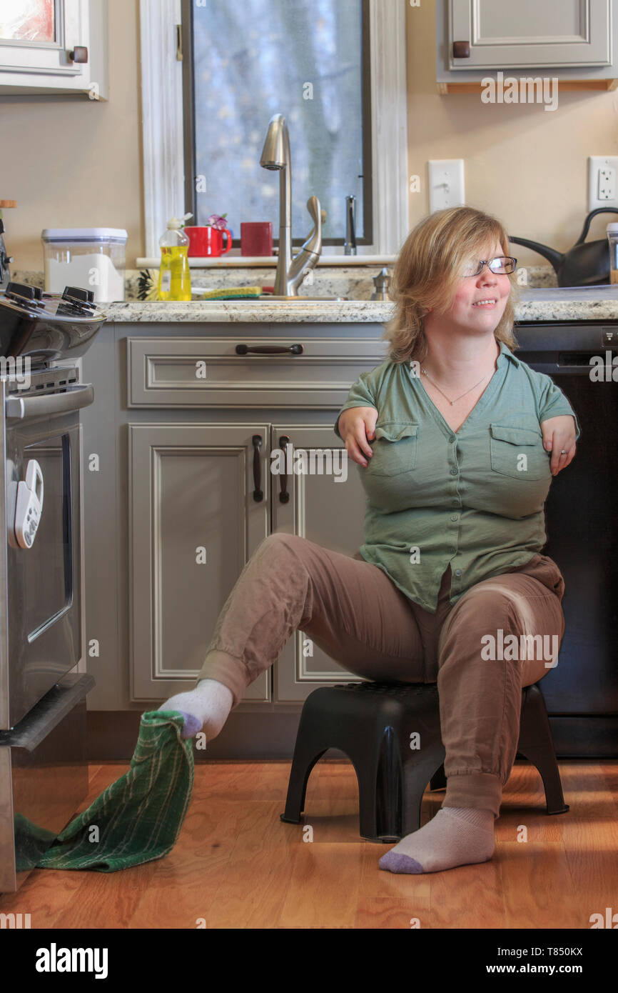 Donna con sindrome di catrame di prelevare un asciugamano da cucina con i suoi piedi Foto Stock