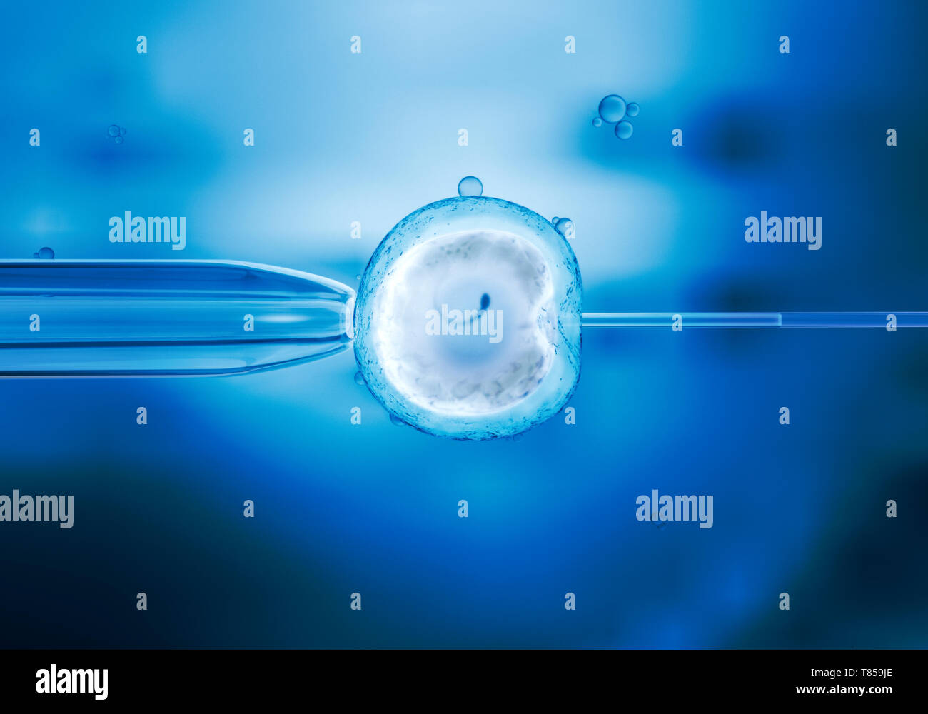 IVF, illustrazione Foto Stock