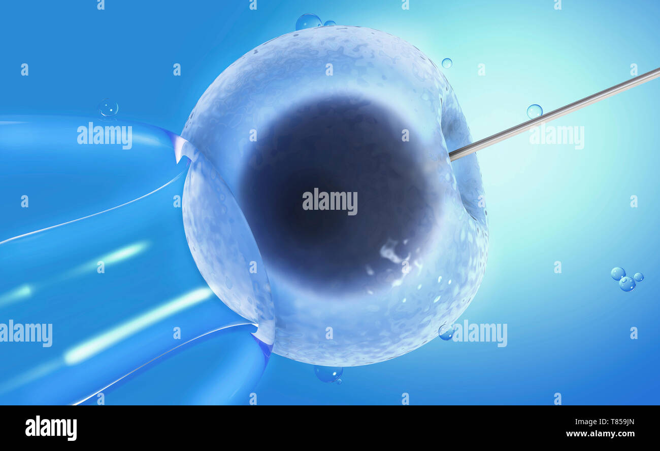 IVF, illustrazione Foto Stock