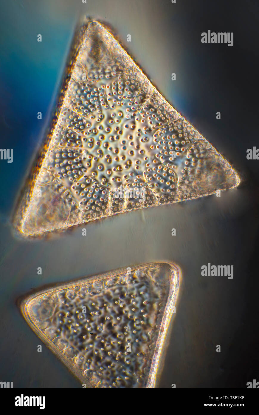 Triceratium diatomee, campo oscuro fotomicrografia Foto Stock