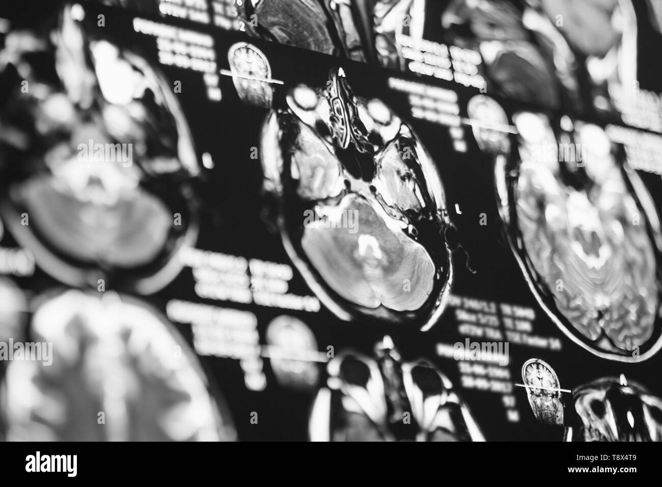 Immagini a risonanza magnetica della testa. Raggi X, MRI, cervello, medicina, la scienza Foto Stock
