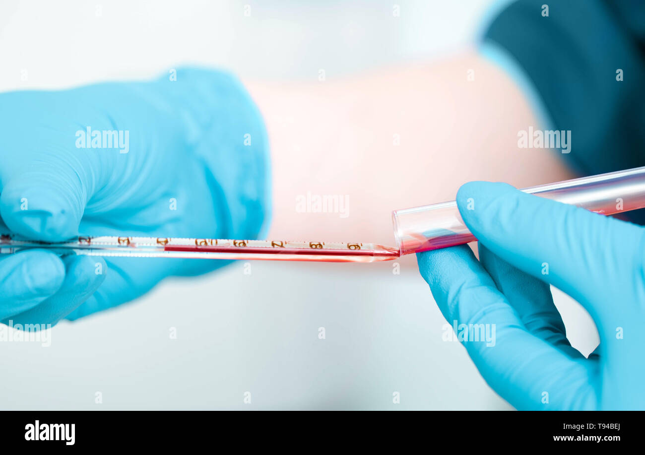 Laboratorio di uno scienziato lavora con campione di sangue , close-up.La ricerca del sangue Foto Stock