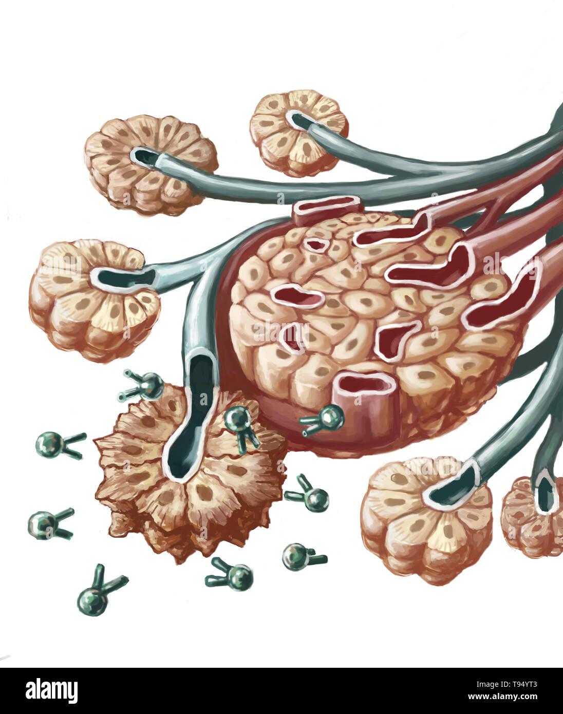 Illustrazione della radioimmunoterapia contro usato per trattare il cancro pancreatico. Un isotopo radioattivo (piombo-212) è combinato con un anticorpo specifico in grado di bersagliare le cellule cancerose. Questa combinazione di anticorpo e piombo-212 radioisotopo viene iniettata per via intravenosa nel corpo fino a che essa non raggiunge il pancreas dove si blocca sulle cellule cancerose' antigene. Il piombo distrugge le cellule mediante irradiazione. Questo trattamento limita la tossicità su cellule sane situato vicino le cellule cancerose. Foto Stock