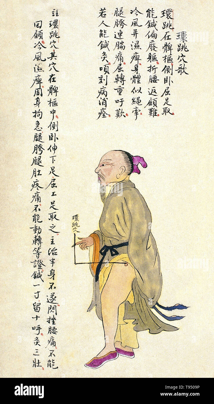 Acu-moxa punto grafico che mostra la huantiao (salto in un cerchio) punto, da Chuanwu lingji lu (Record di sovrana insegnamenti), da Zhang Youheng, un trattato di acu-moxa in due volumi. Questo lavoro sopravvive solo in un manoscritto bozza, completata nel 1869 (ottavo anno del regno Tongzhi periodo della dinastia Qing). Il testo afferma: Il punto huantiao si trova sulla coscia, nel muscolo dietro il grande trocantere. Esso si trova con il paziente sdraiato sul lato con la coscia flessa. Foto Stock