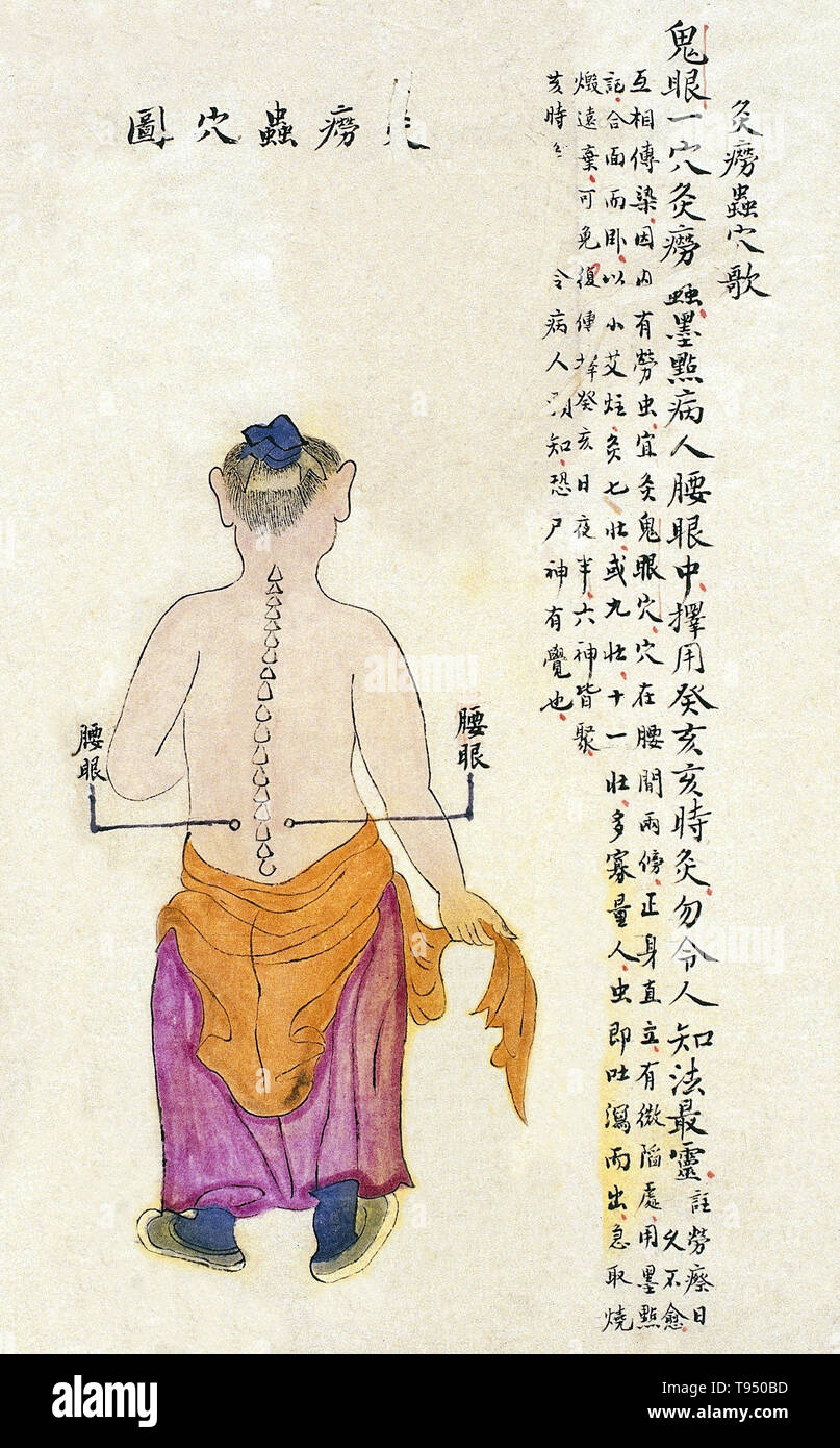 Acu-moxa punto grafico che mostra la yaoyan (lombare occhi) punto, da Chuanwu lingji lu (Record di sovrana insegnamenti), da Zhang Youheng, un trattato di acu-moxa in due volumi. Questo lavoro sopravvive solo in un manoscritto bozza, completata nel 1869 (ottavo anno del regno Tongzhi periodo della dinastia Qing). Foto Stock