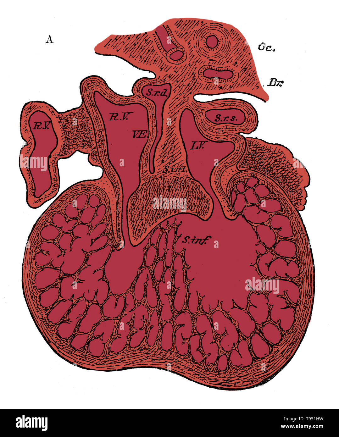 La sezione attraverso il cuore dell embrione umano che mostra la formazione dei setti cardiaci e l'auriculo-ventricolare di valvole, da 5 a 6 settimane. R.V, destra oreillette; L.V, padiglione auricolare sinistro; S.r.d, avvisatore acustico destro del sinus; Sr.s, avvisatore acustico sinistro del sinus; s. int, setto superiore e cuscinetti endocardici (setto intermedium); s. inf, setto deduce ventriculorum; questo setto, così come la massa del ventricolo, è una spugna muscolare in questa fase. Oc, esofago; Br, bronco. Foto Stock