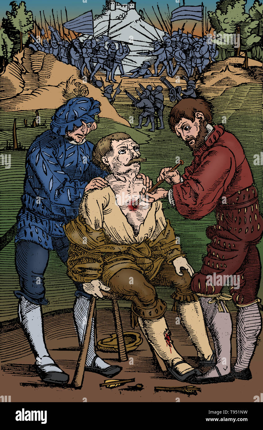La chirurgia del campo di battaglia, 1530. Un soldato ferito avente una punta di freccia estratta dal suo petto come la battaglia continua. Immagine da Feldtbuch des Wundartzney (Fieldbook di Chirurgia) da H. von Gersdorff, Strasburgo. Questa immagine è stato colorizzato. Foto Stock