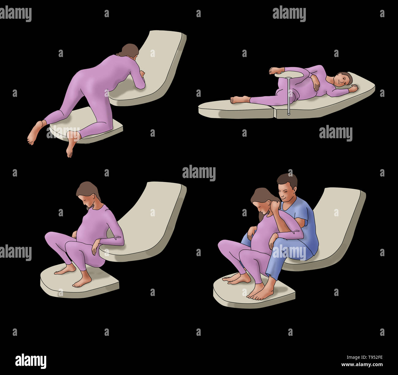 Illustrazione di quattro diverse posizioni del parto: carponi, sdraiato, accucciata, e accovacciata con un partner. Foto Stock