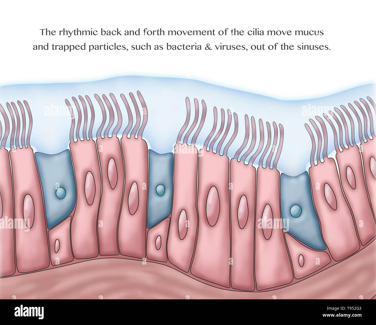 Medical illustrazione illustrante ciglia e il muco. Il ritmico movimento avanti e indietro delle ciglia sposta il muco e le particelle intrappolate, come batteri e virus, fuori dei seni. Foto Stock