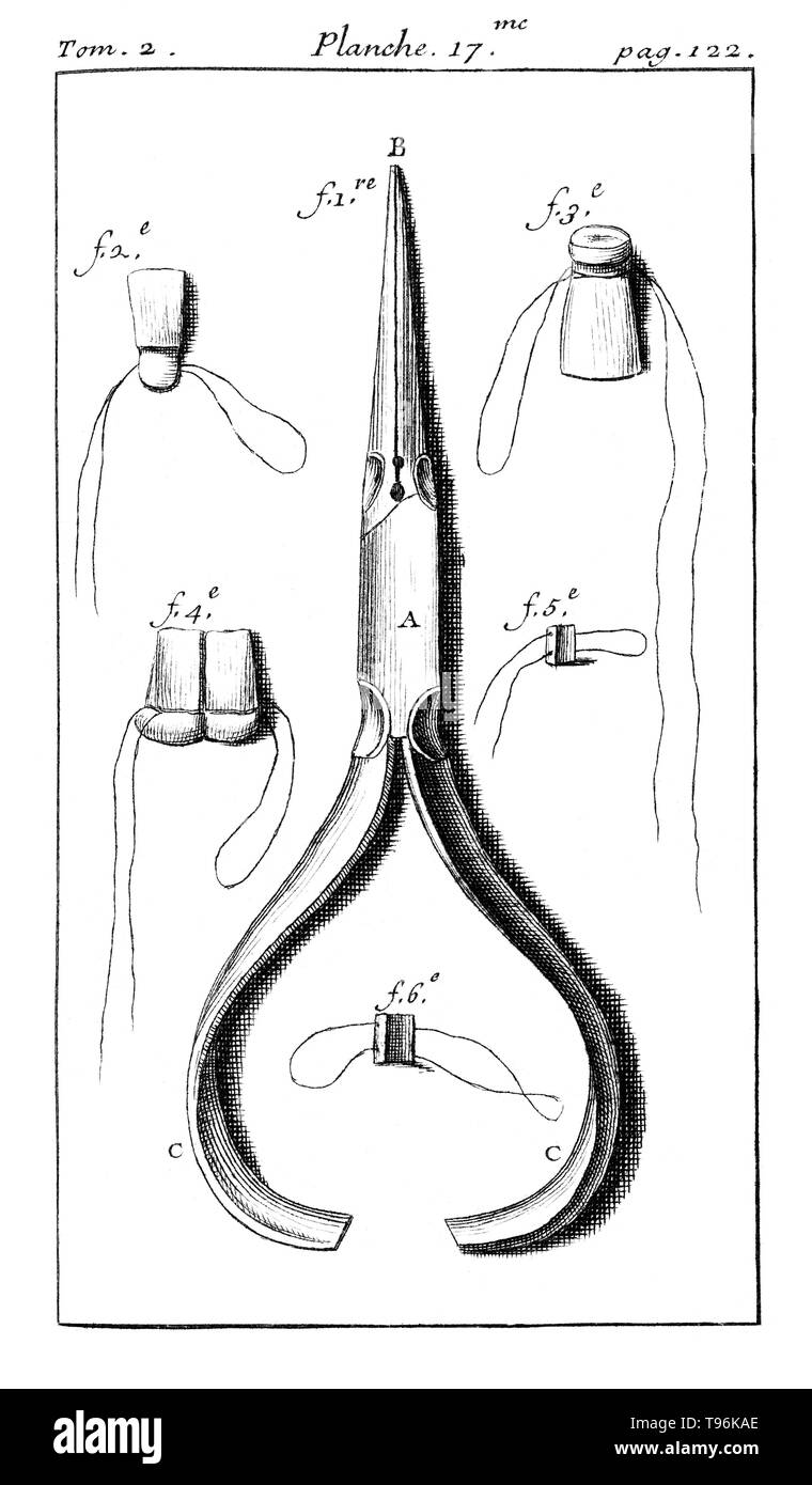 Legatura dentale pinza utilizzata per il restauro di denti. Tome 2. Planche 17. Pagina 122. Pierre Fauchard (1678 - 22 Marzo 1761) era un medico francese, accreditato come il padre della moderna odontoiatria. Egli è ampiamente nota per iscritto la prima descrizione scientifica di odontoiatria, Le Chirurgien Dentiste (il chirurgo dentista), pubblicato nel 1728. Foto Stock