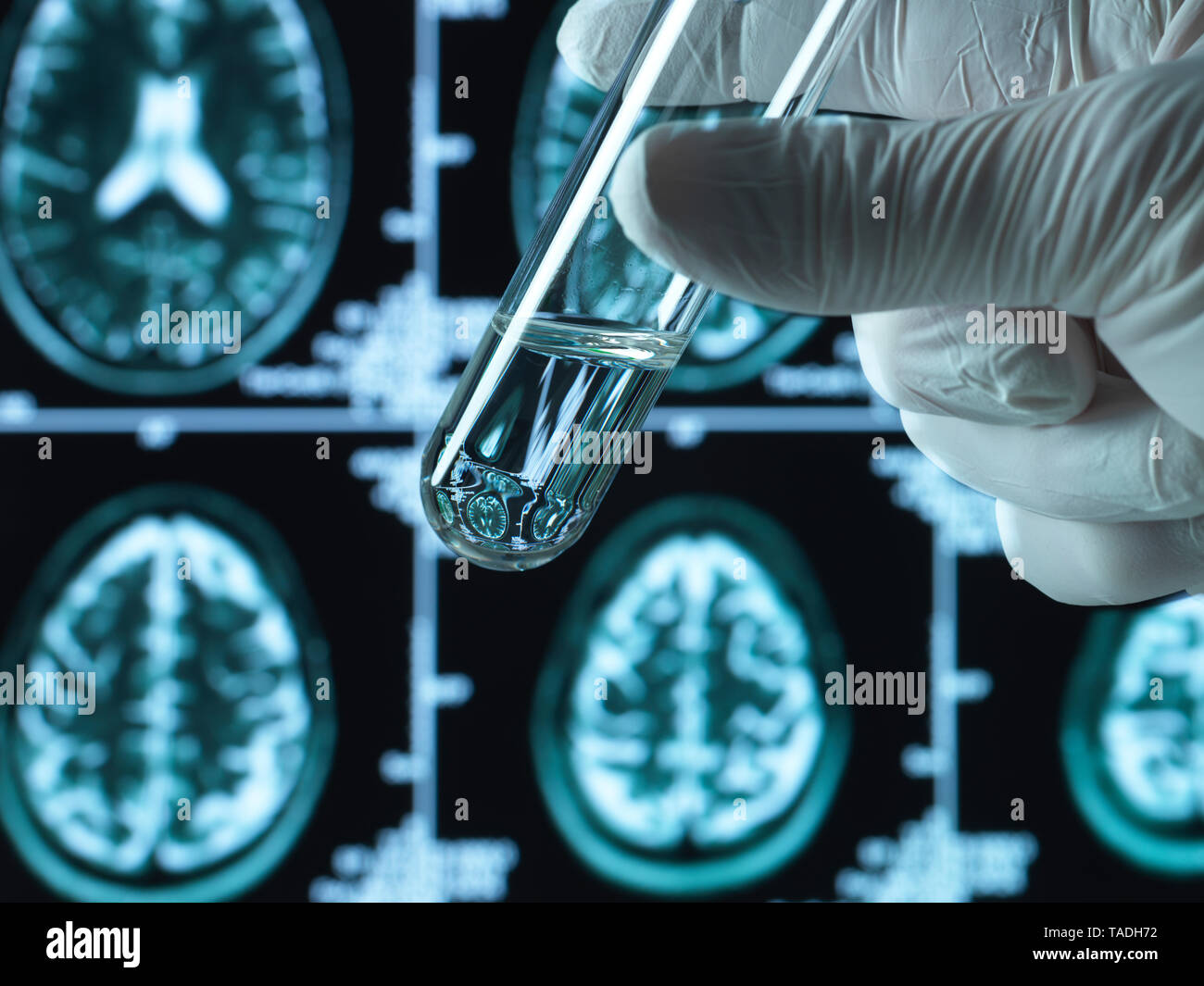 La ricerca farmaceutica in patologie cerebrali inclusa demenza e morbo di alzheimer Foto Stock