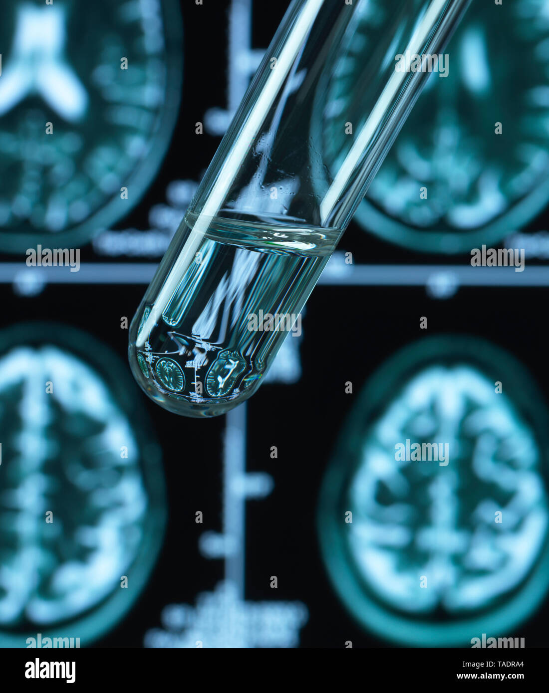 La ricerca farmaceutica in patologie cerebrali inclusa demenza e morbo di alzheimer Foto Stock