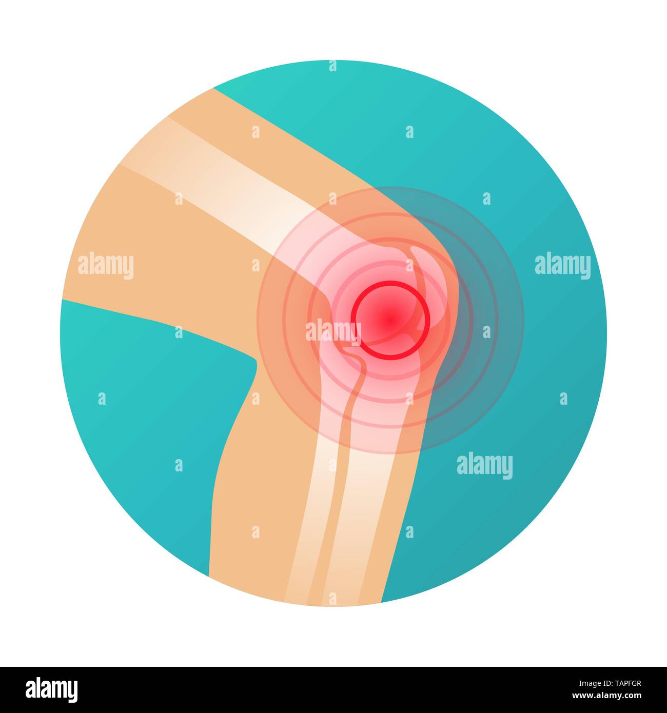 Il dolore alle articolazioni, dolore al ginocchio icona con il cerchio rosso marcatore dolore illustrazione vettoriale. Illustrazione Vettoriale