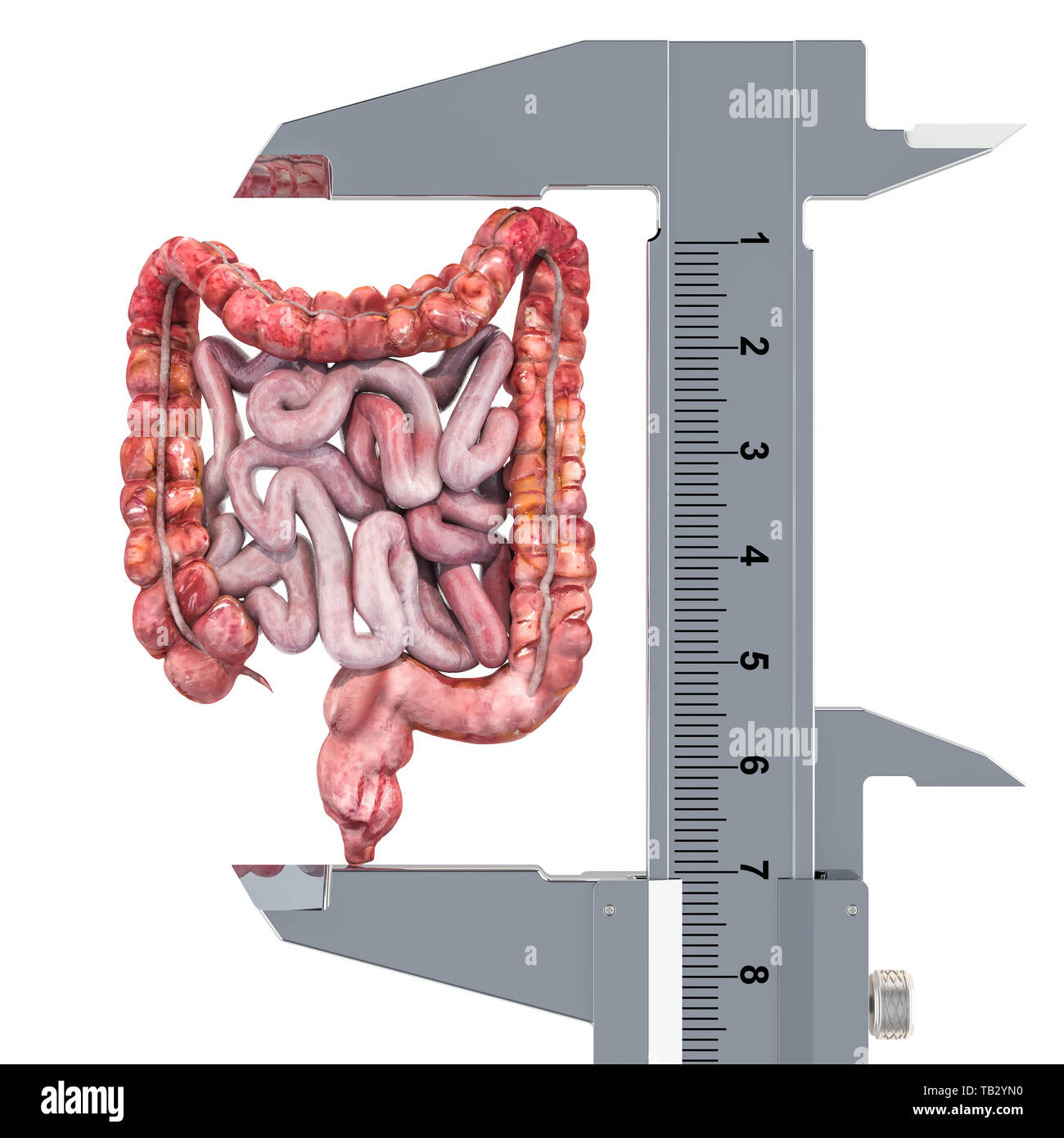 Intestino umano con il calibro a corsoio. La ricerca e la diagnosi di intestino concetto, 3D rendering isolati su sfondo bianco Foto Stock