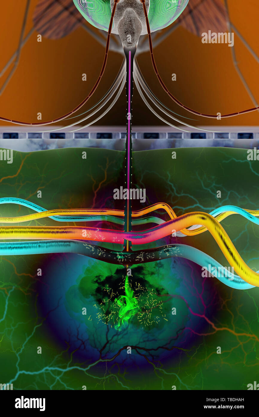 Trasmissione della malaria, illustrazione. Un malaria-zanzara infetta perforare la pelle e la trasmissione dei parassiti della malaria nel sangue. Foto Stock