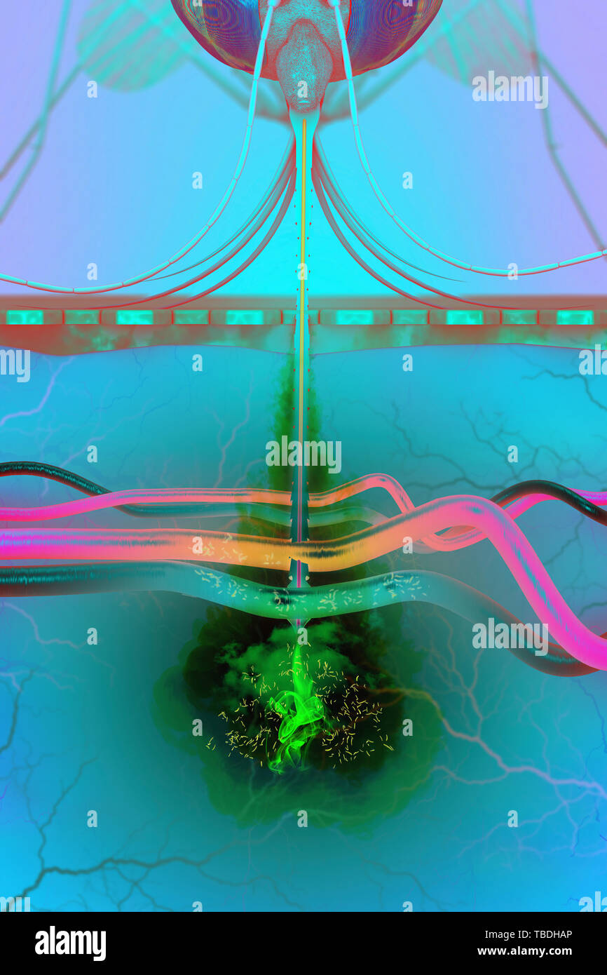 Trasmissione della malaria, illustrazione. Un malaria-zanzara infetta perforare la pelle e la trasmissione dei parassiti della malaria nel sangue. Foto Stock