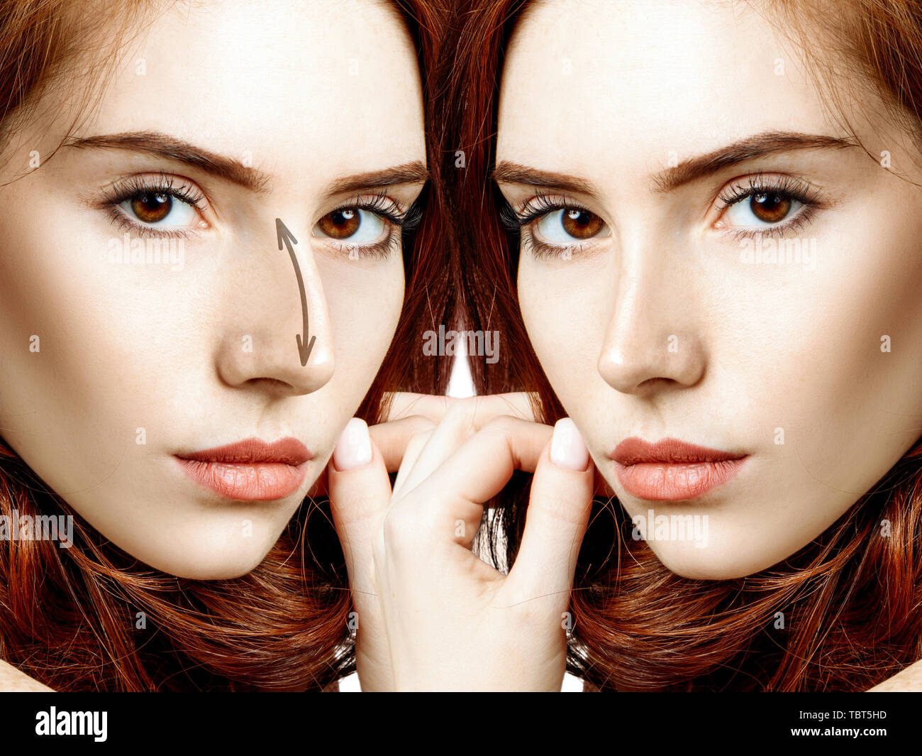 Redhead donna prima e dopo il naso cosmetici chirurgia. Foto Stock