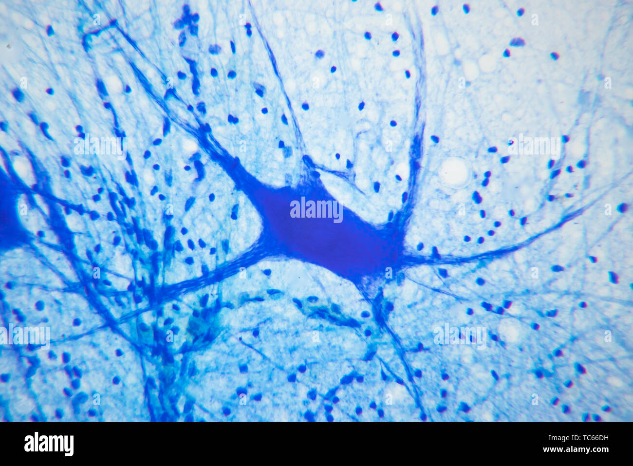 Neuroni motore sotto un elevato ingrandimento, di Coomassie blu brillante mostra il suo citoscheletro. Foto Stock