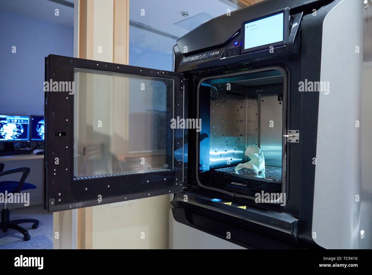 L'impressione 3D di un'anca del paziente da un'immagine medica, stampante 3D, tecnologie di additivo PolyJet o FDM per la prototipazione rapida, RADIOLOGIA OSPEDALE Foto Stock