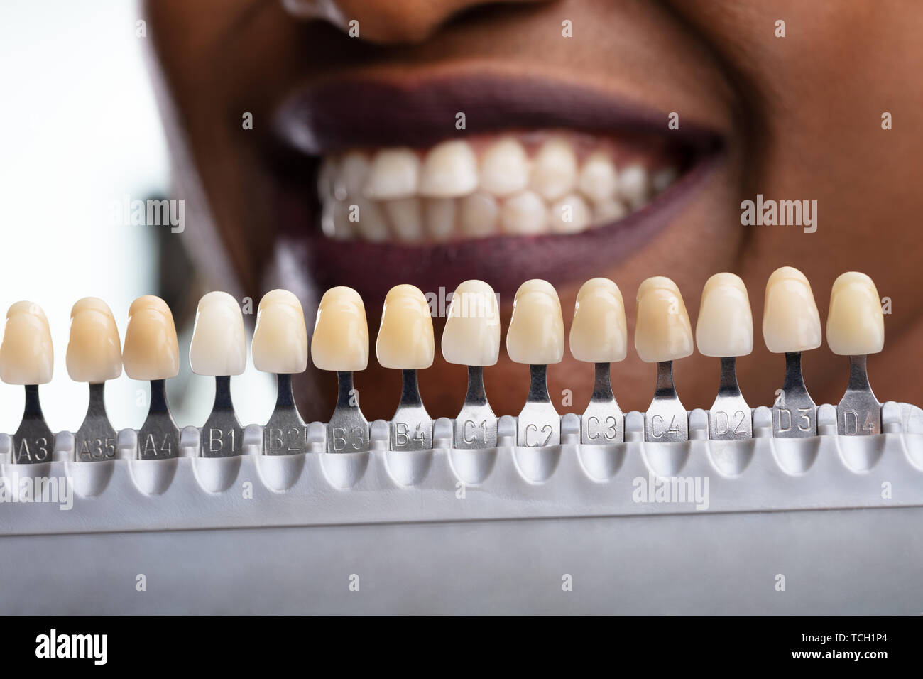 Close-up di una donna felice ombra di adattamento dell'impianto denti Foto Stock
