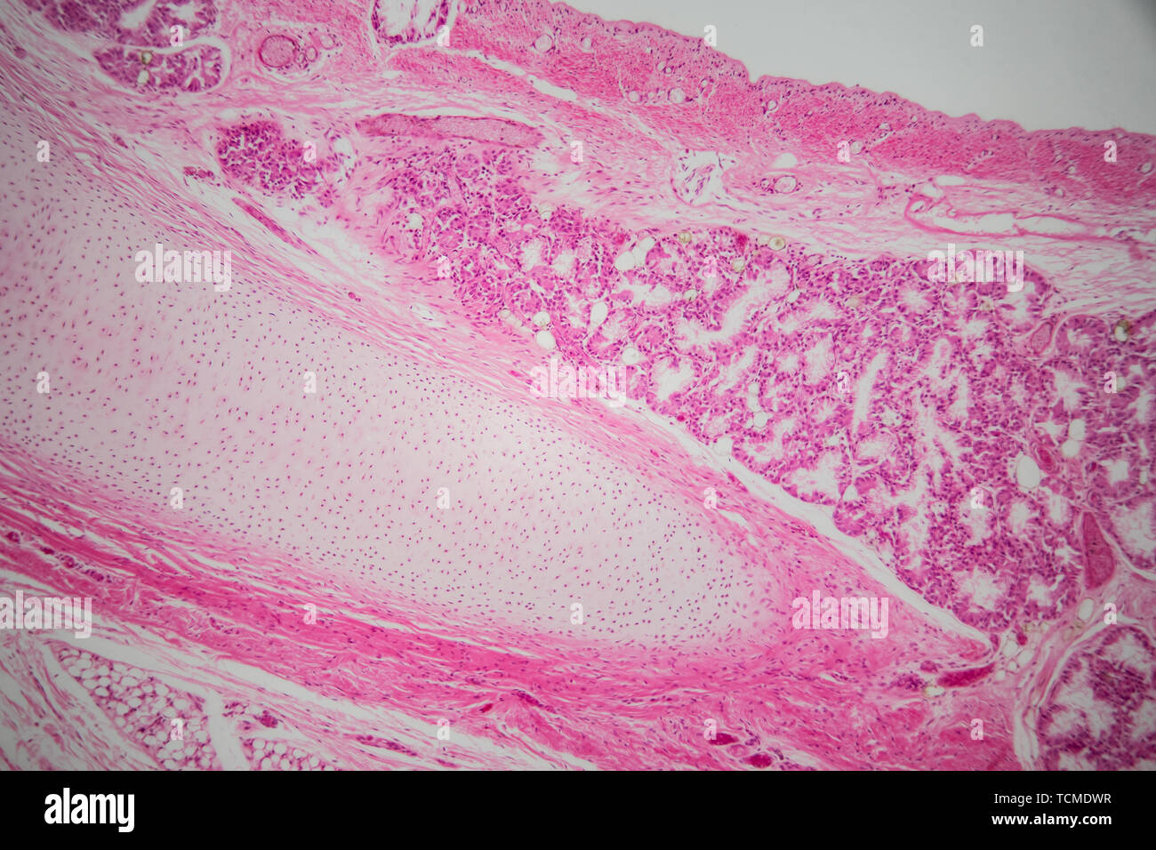 Microscopio ottico, 100 volte sezione trasversale ingrandita dell'asma  bronchiale, che mostra le ghiandole tracheale, anelli di cartilagine e tessuto  epiteliale Foto stock - Alamy