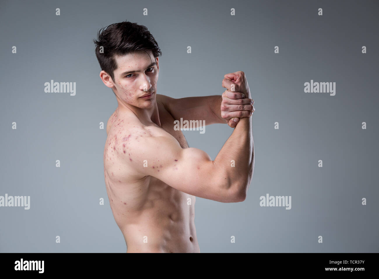 Ritratto in studio giovane uomo caucasico su sfondo grigio in posa. Tema della pubertà, problema della pelle, teen acne. Atleta caucasica fitness. Allergia sport nu Foto Stock