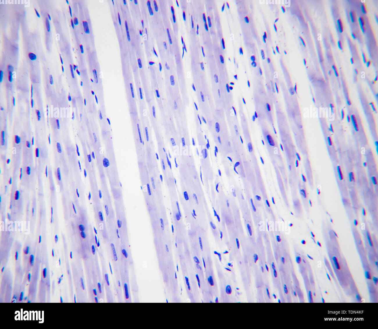 I fibroblasti e fibroblasti sotto una elevata potenza microscopio ottico, tinti da H-E LA COLORAZIONE, ingrandite da 400x Foto Stock