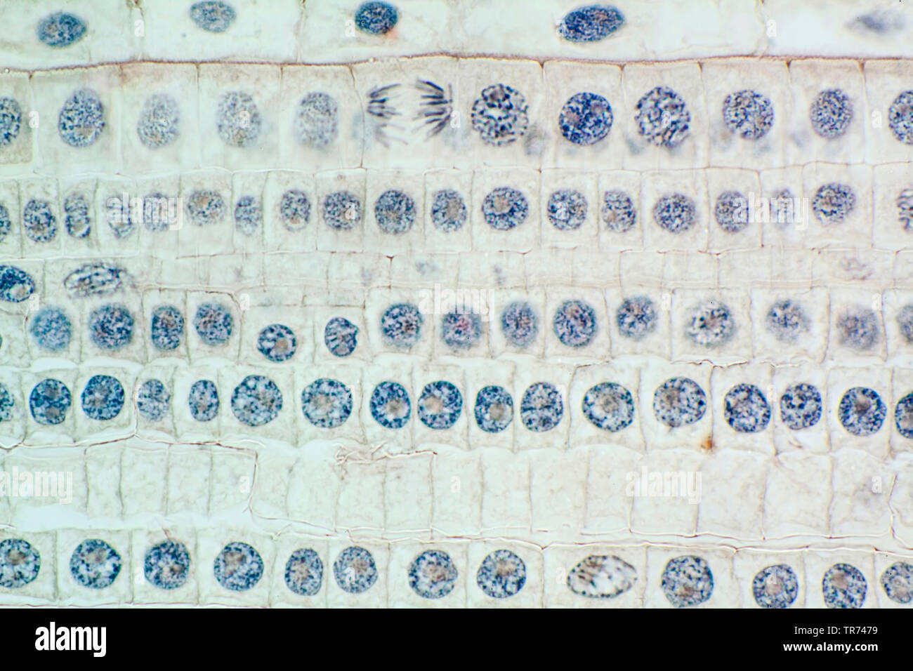 Giardino la cipolla, il bulbo di cipolla, cipolla comune (Allium cepa), del tessuto cellulare di un giardino cipolla con cromosomi tinti, microscopia luminosa, x 120, Germania Foto Stock
