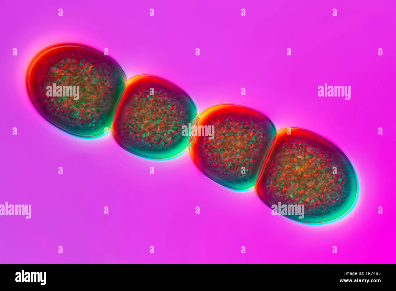 Alga azzurra (Chroococcus spec.), alghe blu-verdi da tessin, Differential Interference Contrast, 120 x, Svizzera Ticino Foto Stock