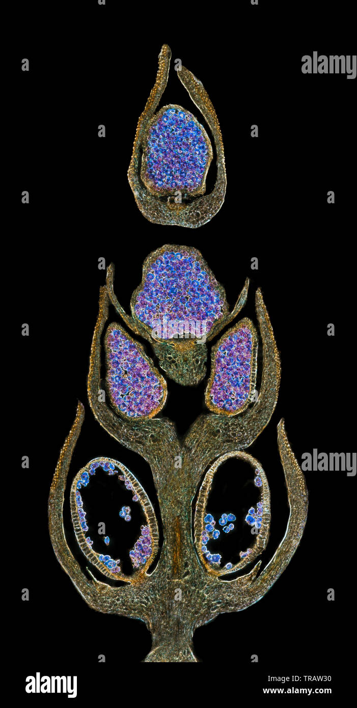 Moss sezione di testa L.S. del cono che mostra spore, Salaginella caulescens. Campo oscuro microfotografia. Foto Stock