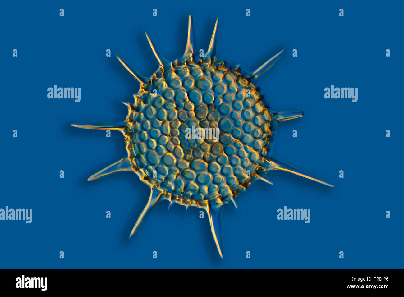 Radiolari (Radiolaria), radiolarian fossili ob Barbados isola con illuminazione a Rheinberg Foto Stock