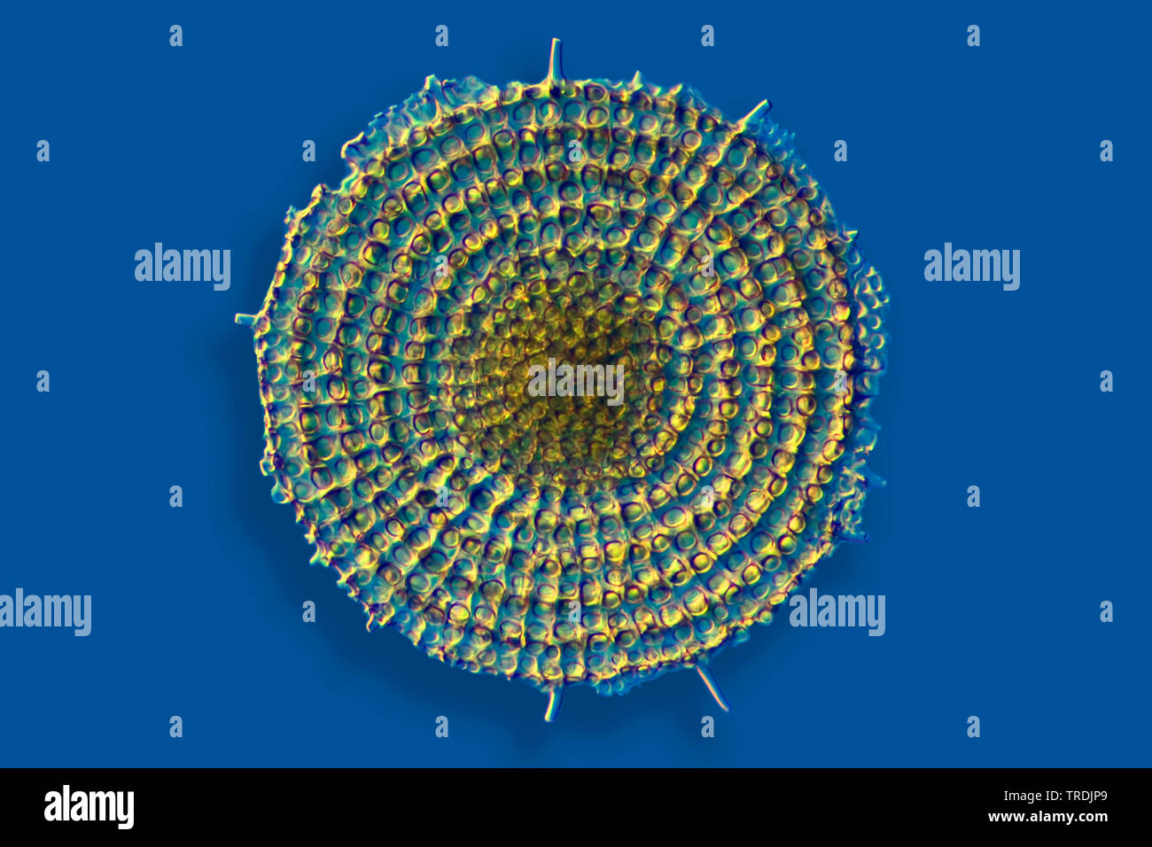 Radiolari (Radiolaria), radiolarian fossili ob Barbados isola con illuminazione a Rheinberg Foto Stock